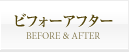 ビフォーアフター